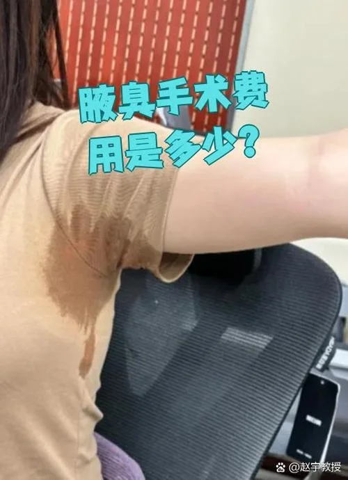 腋臭动手术大概多少钱_2