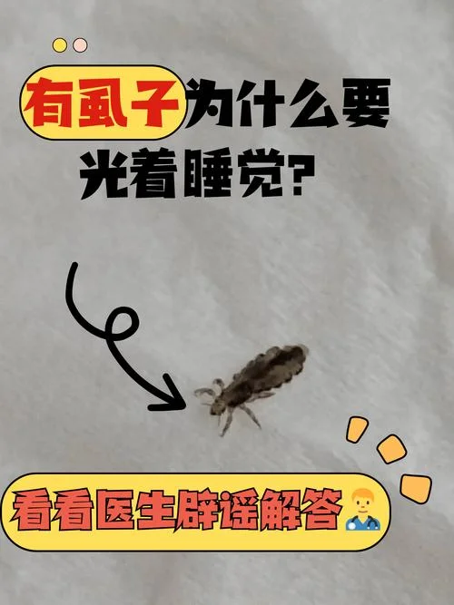 孕妇梦见生虱子-孕妇梦见生虱
