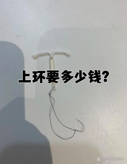 爱母节育环多少钱_2