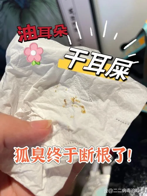 梦到女人掏耳屎_2