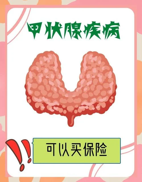 甲状腺可以买什么保险-甲状腺保险购买指南