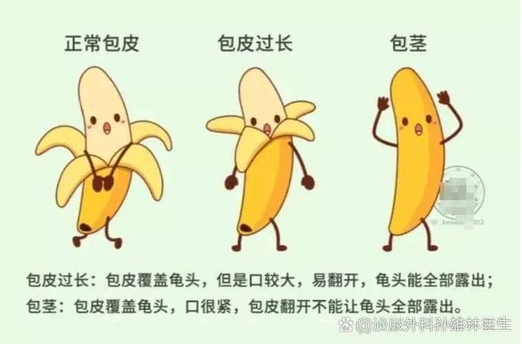 做包皮大概得多少钱-包皮手术大概多少钱