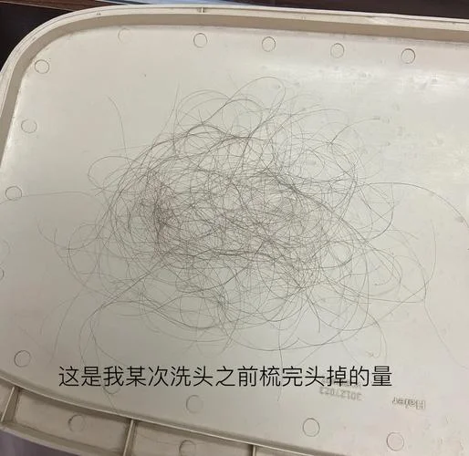 做梦头发白了掉光了_1