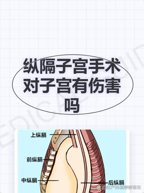 什么是纵隔子宫-什么是纵隔子宫