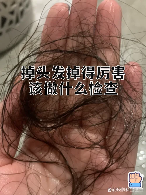 梦到自己大把大把掉头发_2