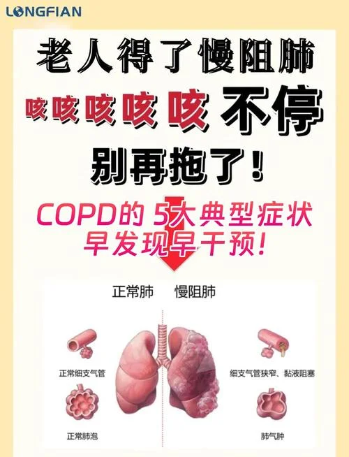 copd 代表什么意思-COPD 代表慢性阻塞性肺疾病
