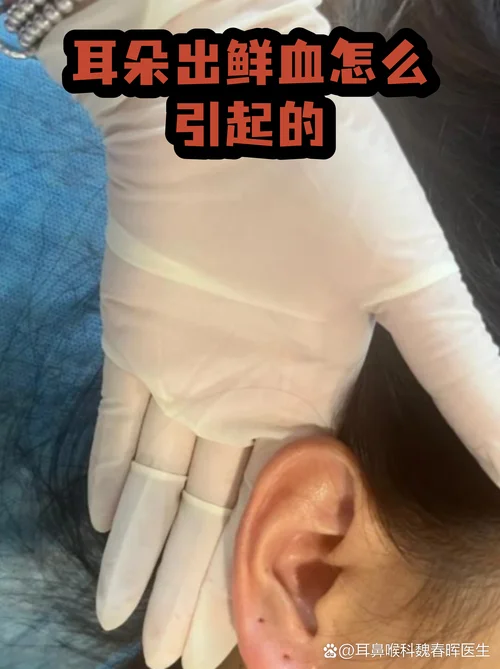 梦见耳朵出血鼻出血_1