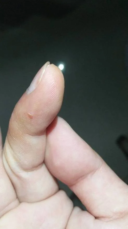 梦见手上被老鼠咬了_2