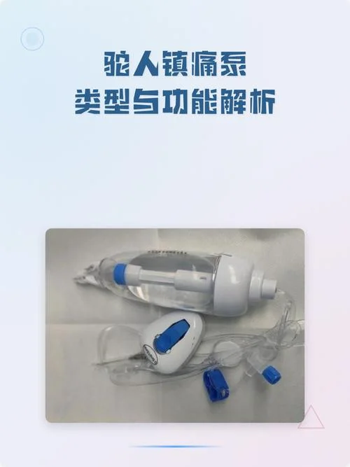 镇痛泵一般多少钱一台_1