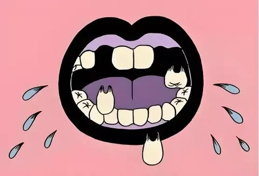 做梦梦见自己蛀牙_2