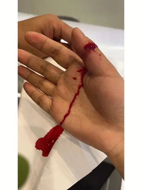 梦到自己手里流血_1