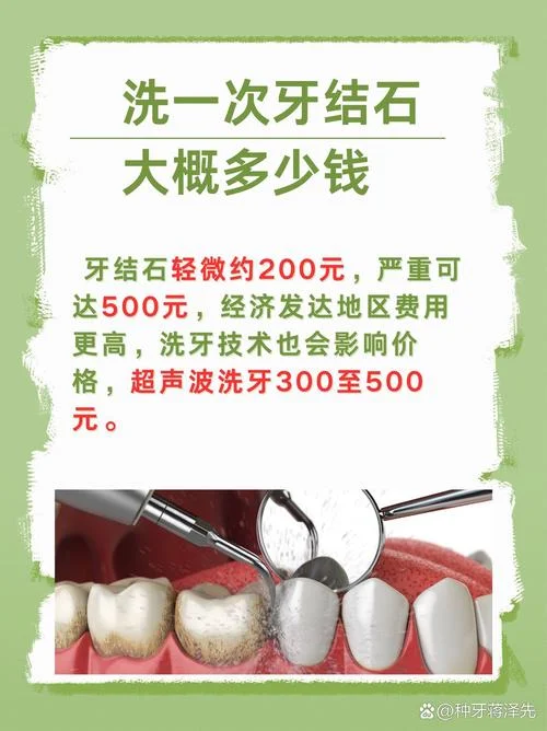 一般洁牙多少钱_1