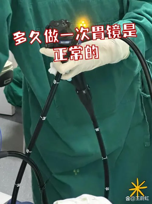 胃镜四项是什么意思-胃镜四项含义