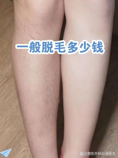 郑州永久脱毛多少钱_1
