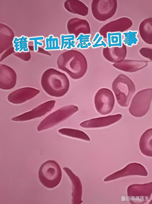 尿红细胞位相什么意思_1