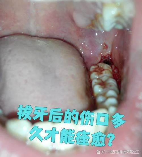 梦到自己拔牙又长新牙_2