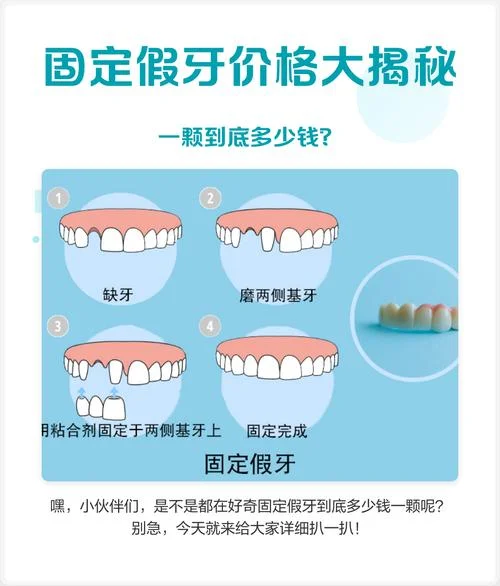 老人假牙多少钱一副-老人假牙价格参考