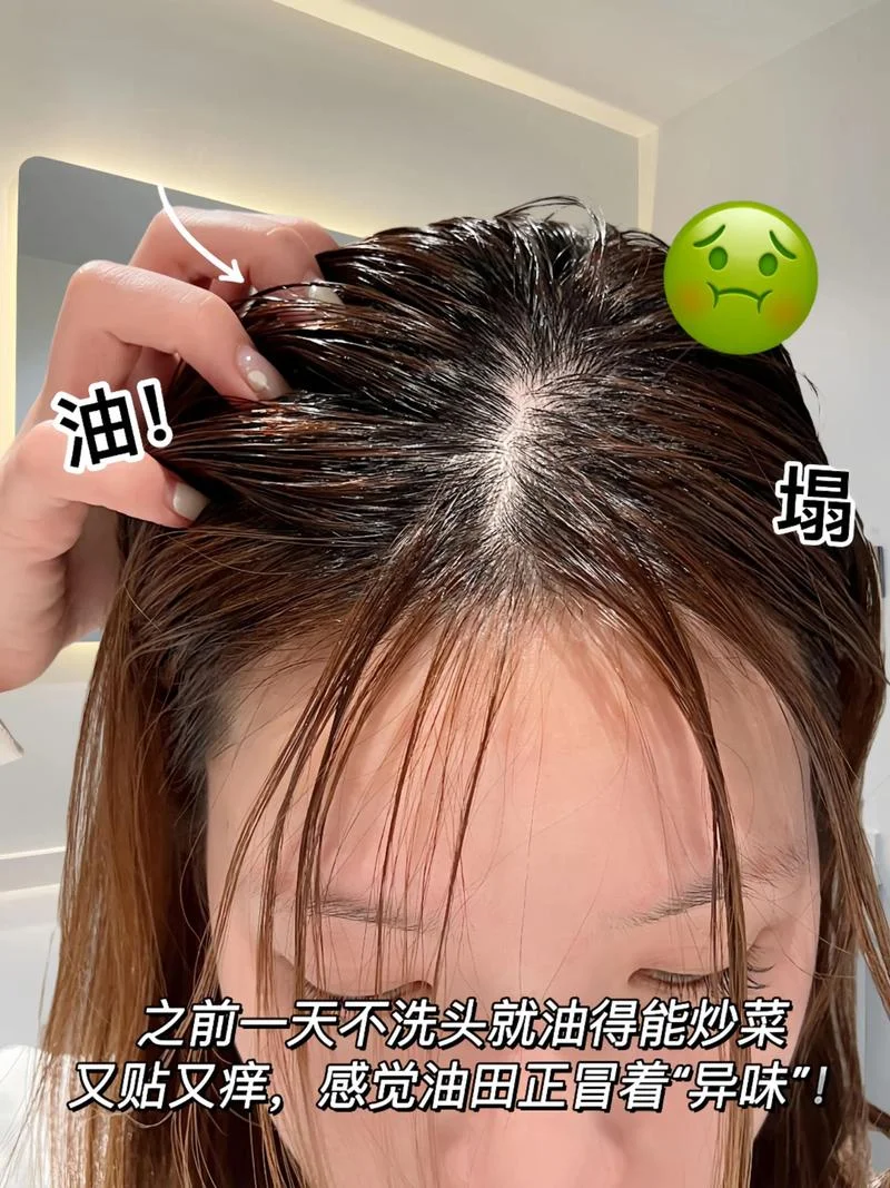 头发太油洗不干净怎么办-头发油腻难洗怎么办