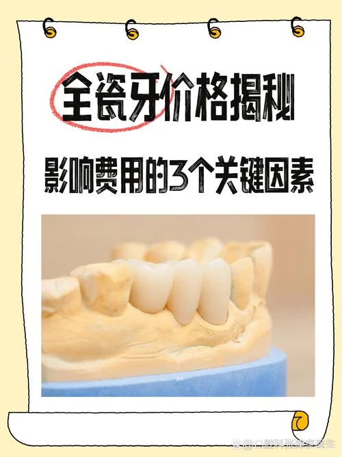 做一口全瓷牙要多少钱_1