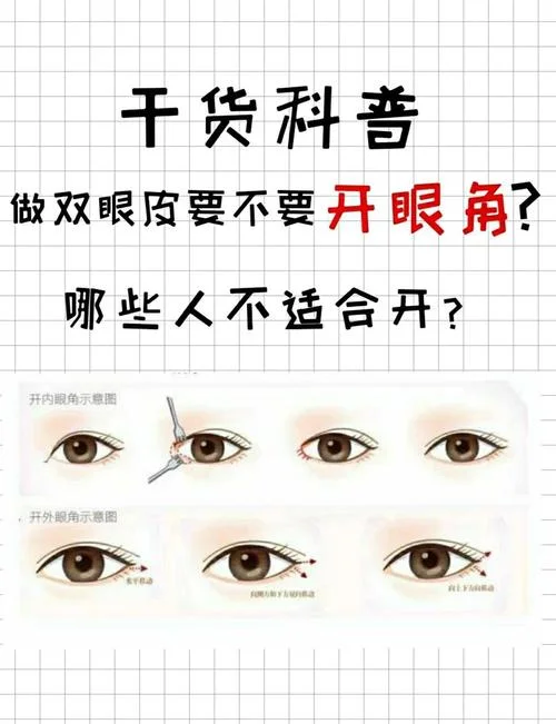 开眼角一般多少钱怎么开呢-开眼角费用与方式