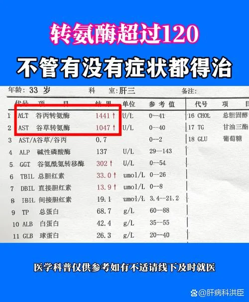 转氨酶低是什么意思-转氨酶低指肝功能异常早期表现