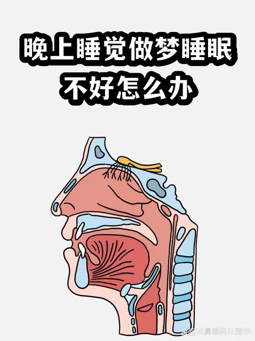 晚上一睡觉就做梦_1