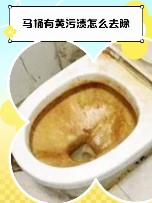 梦见厕所特别脏_1