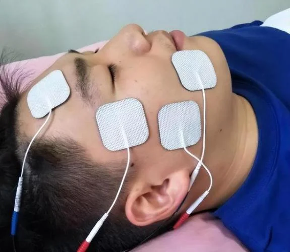 面瘫手术需要多少钱-面瘫手术费用