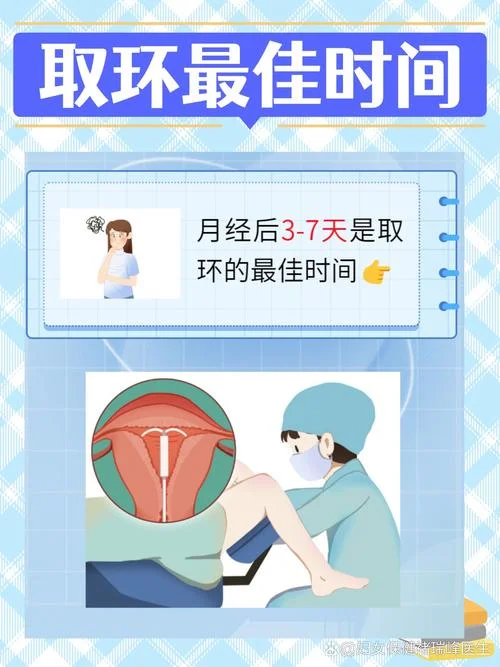 上环200元是放什么环-上环 200 元放什么环