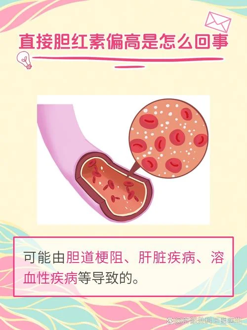 什么是胆红素偏高-胆红素偏高含义