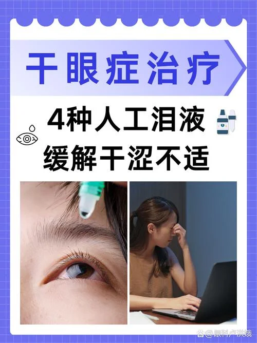 什么是干眼症得了干眼症怎么办-干眼症成因与应对指南
