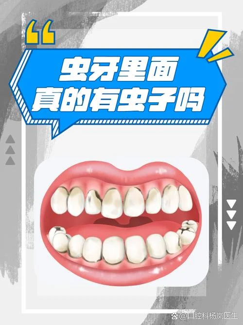 做梦梦见蛀牙牙虫子_2