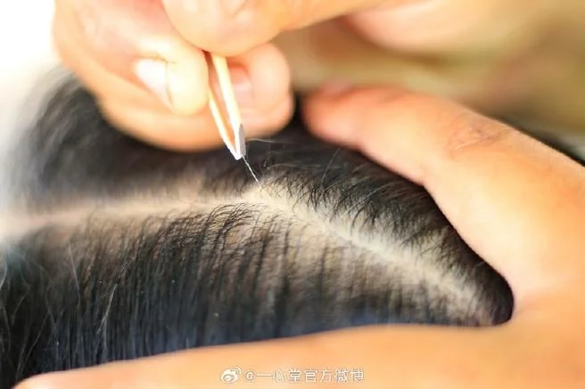 梦见拔白头发_1