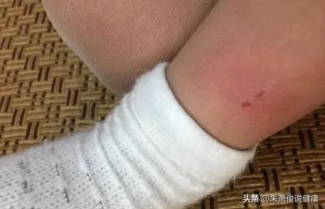 梦见大蜈蚣咬自己的手_1