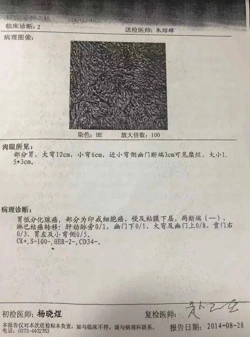 胃炎的诊断证明内容-胃炎诊断证明内容