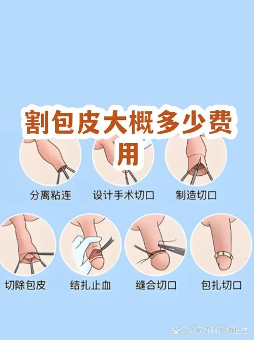 成都割包皮需要多少钱_1