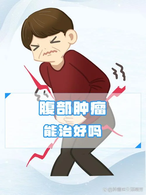腹部肿瘤_2