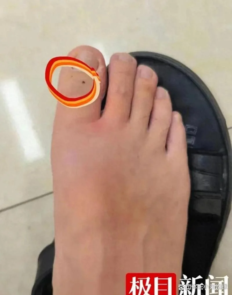 做梦被蛇咬手指出血了_2