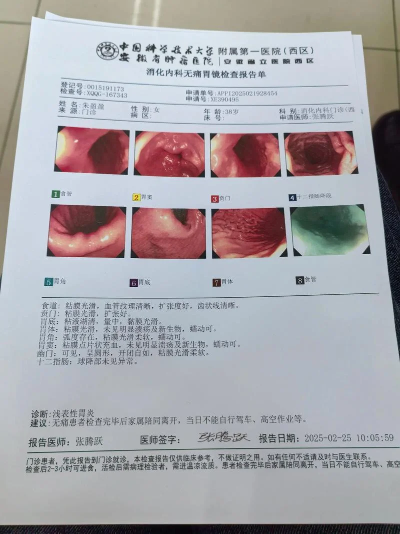 体检项目有胃镜肠镜吗_1