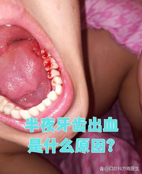 梦见自己大牙掉了出血怎么回事_2