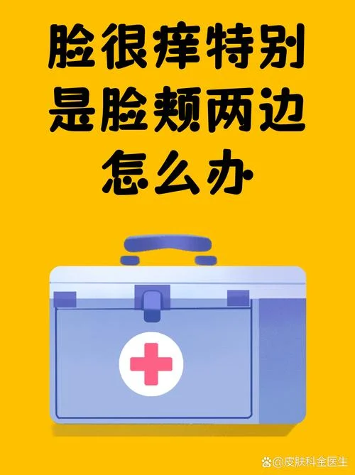 脸特别痒怎么办_1