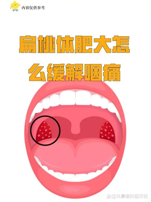 喉咙哽咽是什么意思-喉咙哽咽含义