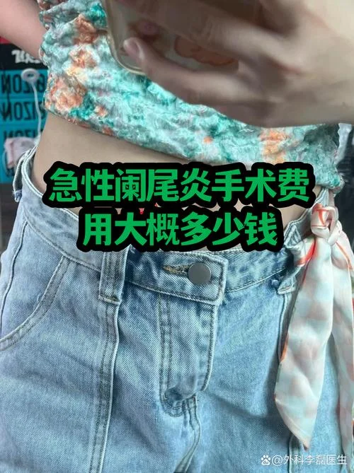小孩阑尾炎手术多少钱-小孩阑尾炎手术费