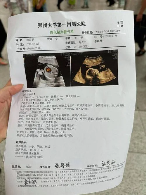 孕妇梦到产检结果不好_2