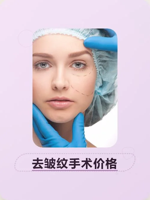 线雕除皱一般多少钱_1