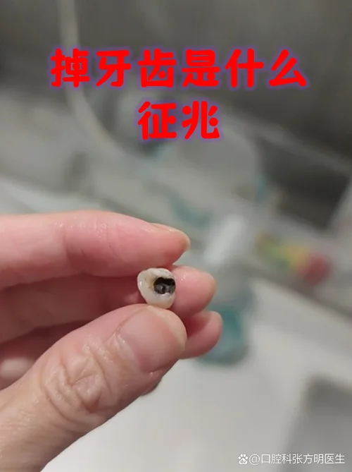 梦见掉牙没出血有事吗_1