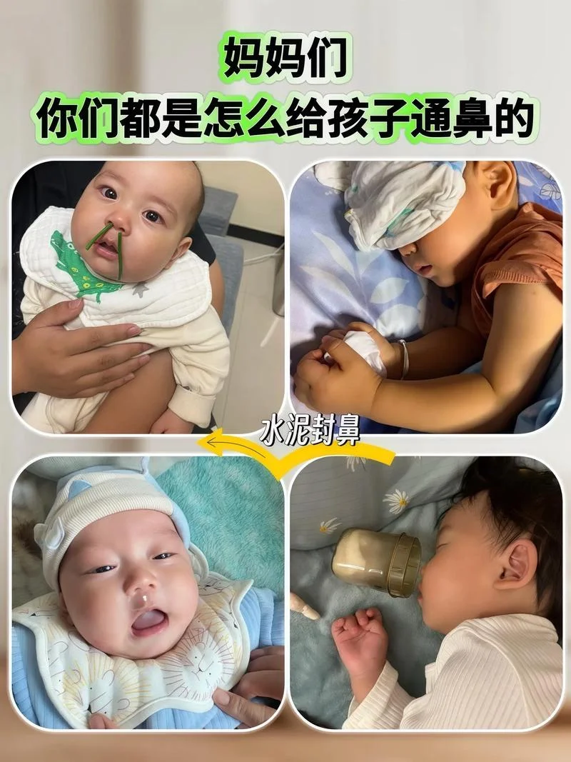 十天新生儿鼻塞怎么办_1