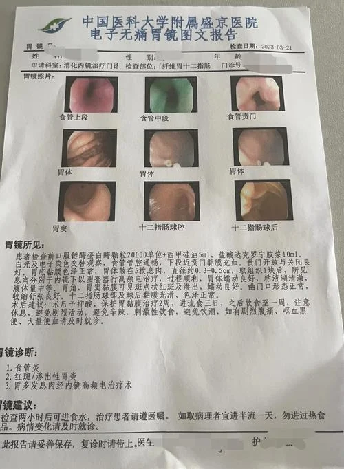 慢性胃炎报告怎么写_2