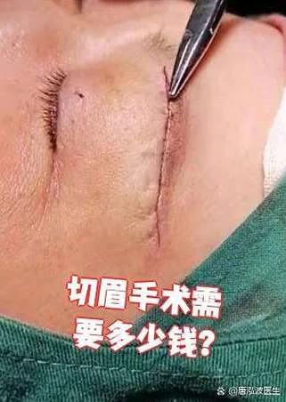 切眉多少钱_1