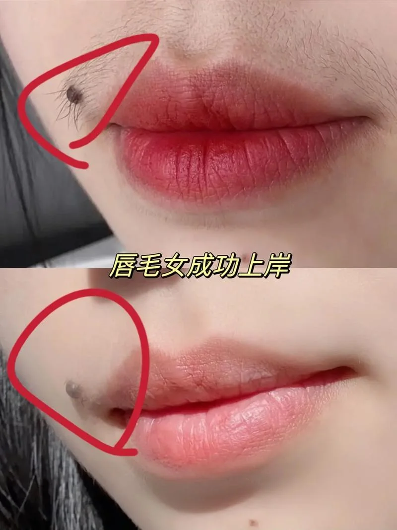 永久脱毛膏怎么用-永久脱毛膏使用方法